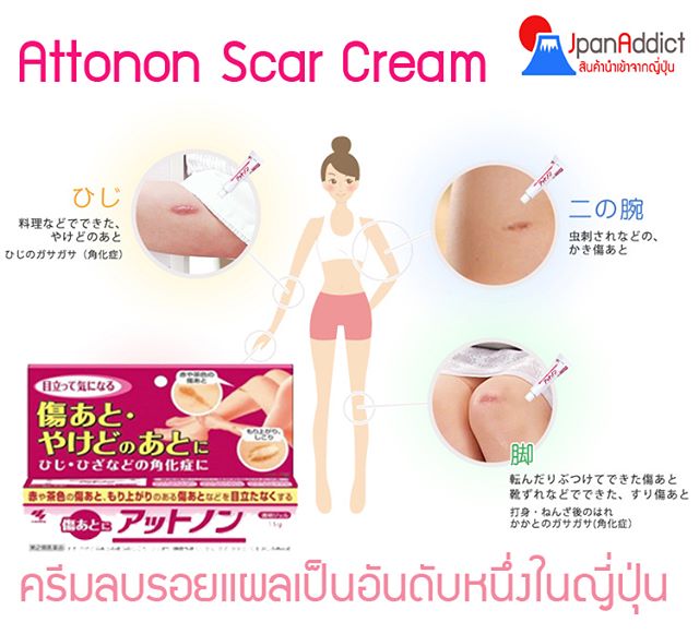 Attonon Scar Cream 